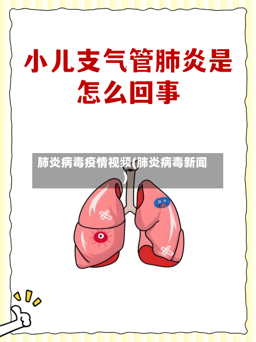 肺炎病毒疫情视频(肺炎病毒新闻)-第2张图片