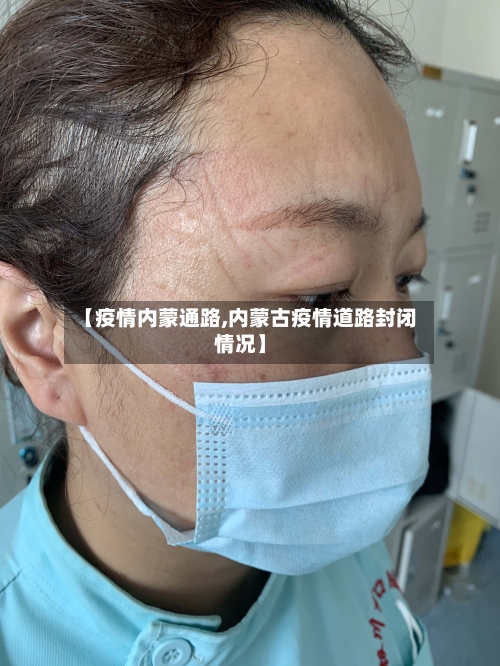 【疫情内蒙通路,内蒙古疫情道路封闭情况】-第2张图片