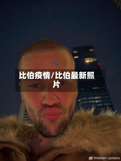 比伯疫情/比伯最新照片