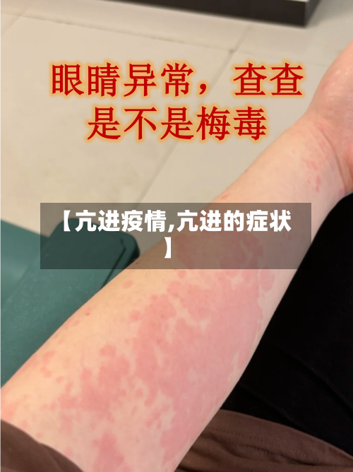 【亢进疫情,亢进的症状】-第2张图片