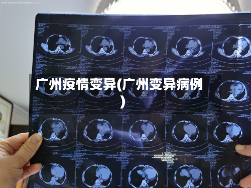 广州疫情变异(广州变异病例)-第3张图片
