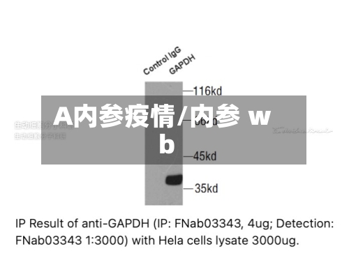 A内参疫情/内参 wb