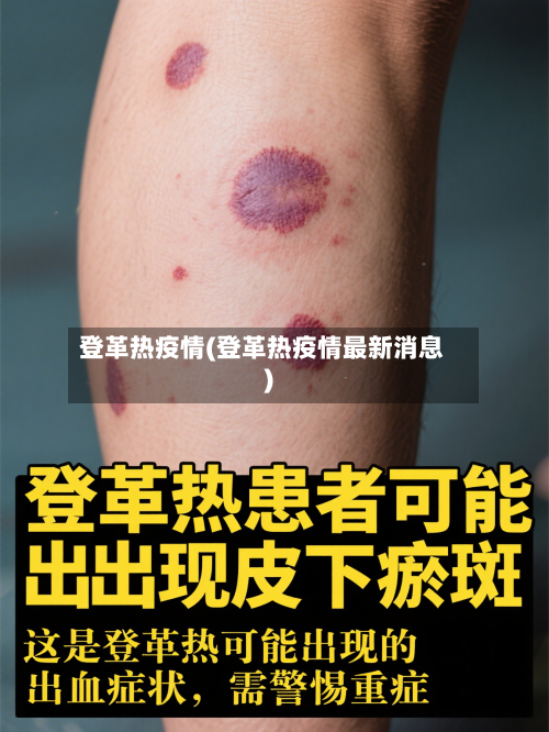 登革热疫情(登革热疫情最新消息)