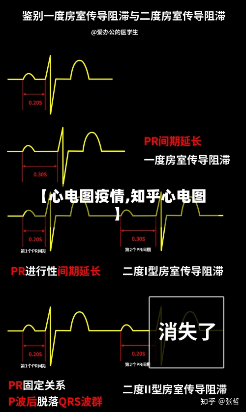 【心电图疫情,知乎心电图】